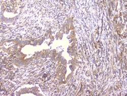 Invitrogen PCDH15 Polyclonal Antibody 100 &mu;g | Buy Online | Invitrogen&trade; | Fisher Scientific