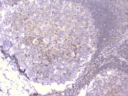 Invitrogen PCDH15 Polyclonal Antibody 100 &mu;g | Buy Online | Invitrogen&trade; | Fisher Scientific