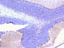 Invitrogen PCDH15 Polyclonal Antibody 100 &mu;g | Buy Online | Invitrogen&trade; | Fisher Scientific