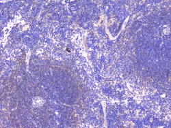 Invitrogen PCDH15 Polyclonal Antibody 100 &mu;g | Buy Online | Invitrogen&trade; | Fisher Scientific