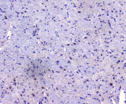 Invitrogen PCDH15 Polyclonal Antibody 100 &mu;g | Buy Online | Invitrogen&trade; | Fisher Scientific