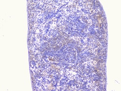 Invitrogen PCDH15 Polyclonal Antibody 100 &mu;g | Buy Online | Invitrogen&trade; | Fisher Scientific