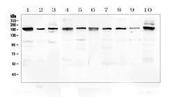 Invitrogen PCDH15 Polyclonal Antibody 100 &mu;g | Buy Online | Invitrogen&trade; | Fisher Scientific