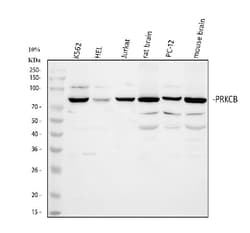 Invitrogen PKC beta-1 Polyclonal Antibody 100 &mu;g | Buy Online | Invitrogen&trade; | Fisher Scientific