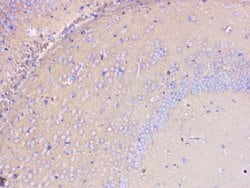 Invitrogen PKC gamma Polyclonal Antibody 100 &mu;g; Unconjugated:Antibodies,