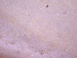 Invitrogen PKC gamma Polyclonal Antibody 100 &mu;g; Unconjugated:Antibodies,