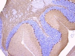 Invitrogen PKC gamma Polyclonal Antibody 100 &mu;g; Unconjugated:Antibodies,