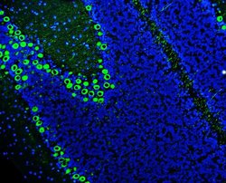 Invitrogen PKC gamma Polyclonal Antibody 100 &mu;g; Unconjugated:Antibodies,