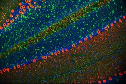 Invitrogen PKC gamma Polyclonal Antibody 100 &mu;g; Unconjugated:Antibodies,