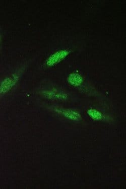 Invitrogen Sorcin Polyclonal Antibody 100 &mu;g; Unconjugated:Antibodies,