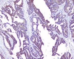 Invitrogen Sorcin Polyclonal Antibody 100 &mu;g; Unconjugated:Antibodies,