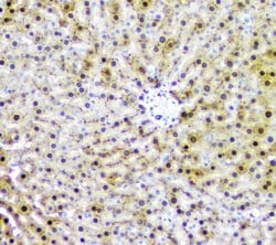 Invitrogen AKR1D1 Polyclonal Antibody 100 &mu;g; Unconjugated:Antibodies,