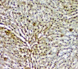 Invitrogen AKR1D1 Polyclonal Antibody 100 &mu;g; Unconjugated:Antibodies,
