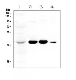 Invitrogen AKR1D1 Polyclonal Antibody 100 &mu;g; Unconjugated:Antibodies,