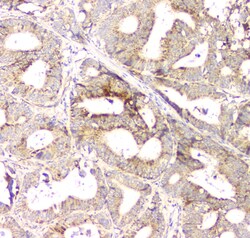 Invitrogen APRT Polyclonal Antibody 100 &mu;g; Unconjugated:Antibodies,