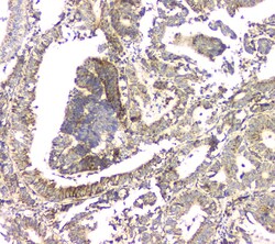 Invitrogen APRT Polyclonal Antibody 100 &mu;g; Unconjugated:Antibodies,