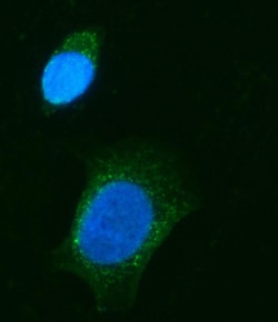 Invitrogen CHM Polyclonal Antibody 100 &mu;g | Buy Online | Invitrogen&trade; | Fisher Scientific