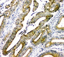 Invitrogen DOK7 Polyclonal Antibody 100 &mu;g; Unconjugated:Antibodies,