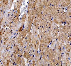 Invitrogen DOK7 Polyclonal Antibody 100 &mu;g; Unconjugated:Antibodies,