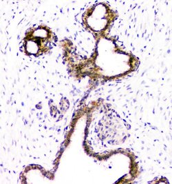 Invitrogen DOK7 Polyclonal Antibody 100 &mu;g; Unconjugated:Antibodies,