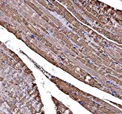 Invitrogen DOK7 Polyclonal Antibody 100 &mu;g; Unconjugated:Antibodies,