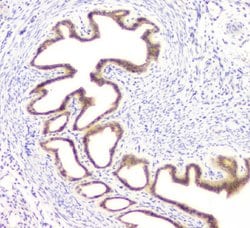 Invitrogen DOK7 Polyclonal Antibody 100 &mu;g; Unconjugated:Antibodies,