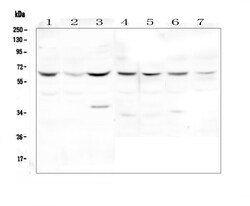 Invitrogen DOK7 Polyclonal Antibody 100 &mu;g; Unconjugated:Antibodies,