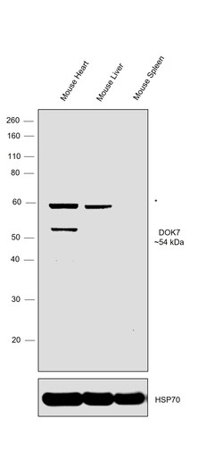 Invitrogen DOK7 Polyclonal Antibody 100 &mu;g; Unconjugated:Antibodies,