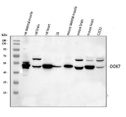 Invitrogen DOK7 Polyclonal Antibody 100 &mu;g; Unconjugated:Antibodies,