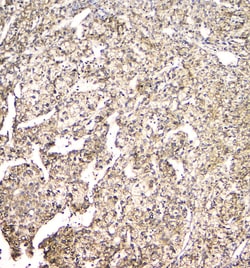 Invitrogen TMEM166 Polyclonal Antibody 100 &mu;g; Unconjugated:Antibodies,