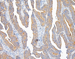 Invitrogen IQGAP1 Polyclonal Antibody 100 &mu;g | Buy Online | Invitrogen&trade; | Fisher Scientific
