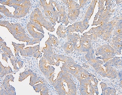 Invitrogen IQGAP1 Polyclonal Antibody 100 &mu;g | Buy Online | Invitrogen&trade; | Fisher Scientific