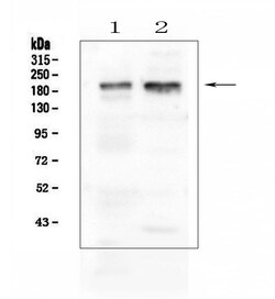 Invitrogen IQGAP1 Polyclonal Antibody 100 &mu;g | Buy Online | Invitrogen&trade; | Fisher Scientific