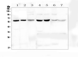 Invitrogen tPA Polyclonal Antibody 100 &mu;g; Unconjugated:Antibodies,