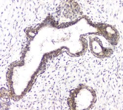 Invitrogen RhoB Polyclonal Antibody 100 &mu;g; Unconjugated:Antibodies,