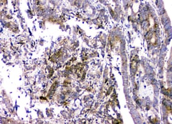 Invitrogen RMI2 Polyclonal Antibody 100 &mu;g | Buy Online | Invitrogen&trade; | Fisher Scientific