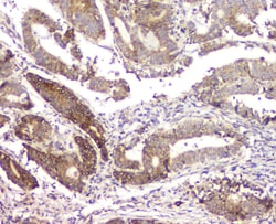 Invitrogen RMI2 Polyclonal Antibody 100 &mu;g | Buy Online | Invitrogen&trade; | Fisher Scientific