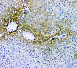Invitrogen RMI2 Polyclonal Antibody 100 &mu;g | Buy Online | Invitrogen&trade; | Fisher Scientific