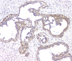 Invitrogen RMI2 Polyclonal Antibody 100 &mu;g | Buy Online | Invitrogen&trade; | Fisher Scientific