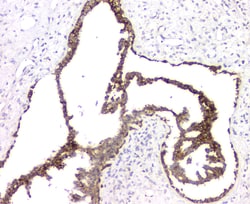 Invitrogen RMI2 Polyclonal Antibody 100 &mu;g | Buy Online | Invitrogen&trade; | Fisher Scientific