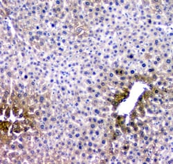 Invitrogen&trade;&nbsp;RMI2 Polyclonal Antibody