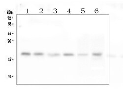 Invitrogen RMI2 Polyclonal Antibody 100 &mu;g | Buy Online | Invitrogen&trade; | Fisher Scientific