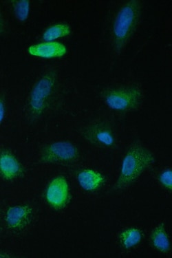 Invitrogen TIM17 Polyclonal Antibody 100 &mu;g; Unconjugated:Antibodies,