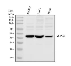 Invitrogen ZP3 Polyclonal Antibody 100 &mu;g; Unconjugated:Antibodies,