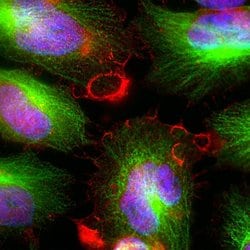 Invitrogen MARCKS Polyclonal Antibody 100 &mu;L; Unconjugated:Antibodies,