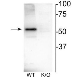 Invitrogen CHRNB4 Polyclonal Antibody 100 &mu;L | Buy Online | Invitrogen&trade; | Fisher Scientific