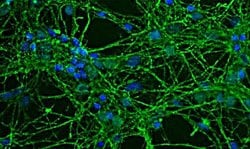 Invitrogen GAP43 Polyclonal Antibody 100 &mu;L; Unconjugated:Antibodies,