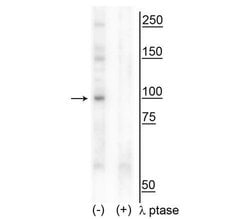 Invitrogen Phospho-CtIP (Thr847) Polyclonal Antibody 100 &mu;L; Unconjugated:Antibodies,