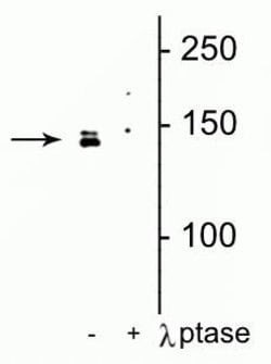 Invitrogen Phospho-DENND3 (Ser554) Polyclonal Antibody 100 &mu;L; Unconjugated:Antibodies,