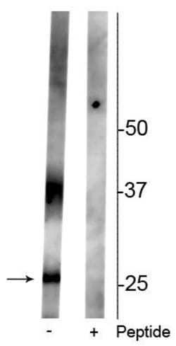 Invitrogen Phospho-Aquaporin 2 (Ser261) Polyclonal Antibody 100 &mu;L;